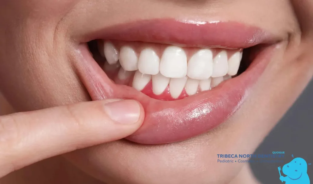 Common Causes of Toothache Pain