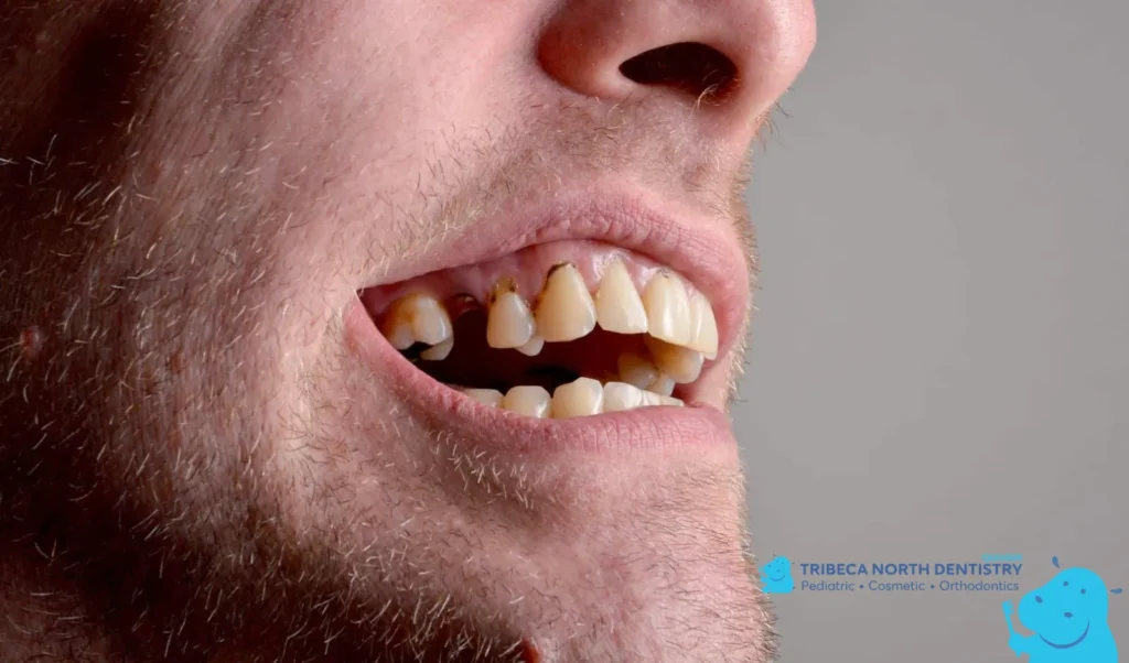 Common Causes of Toothache Pain