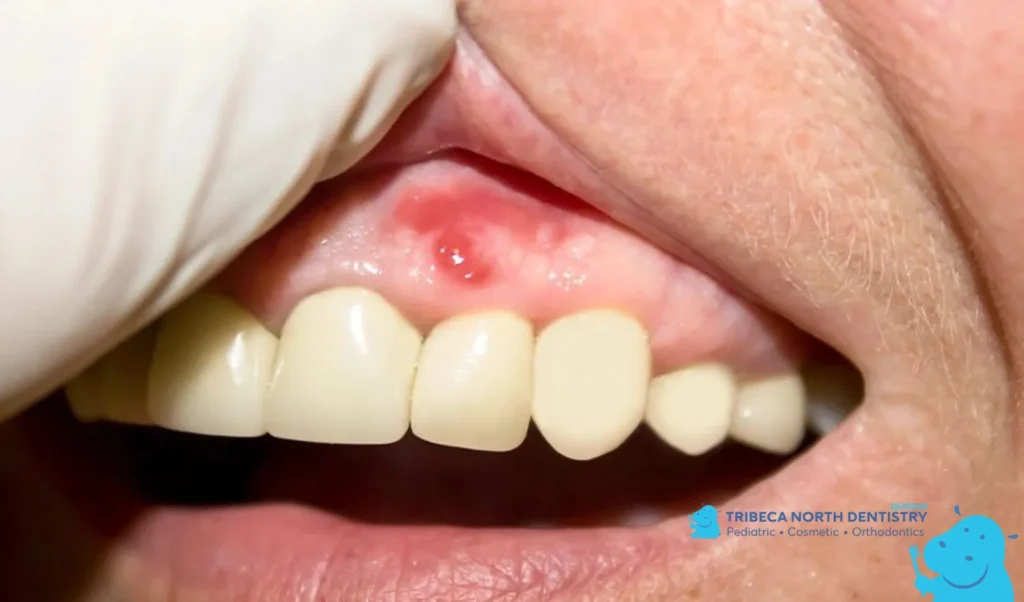 Dental Issues That Commonly Trigger Tooth Pain