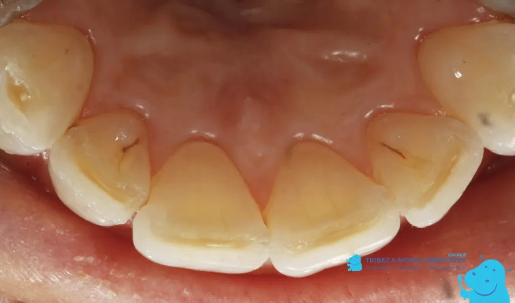 Possible Causes of Tooth and Gum Pain