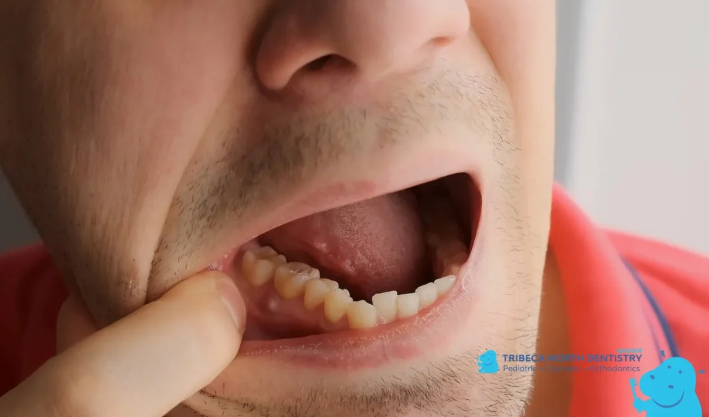 Take Tooth Pain Seriously