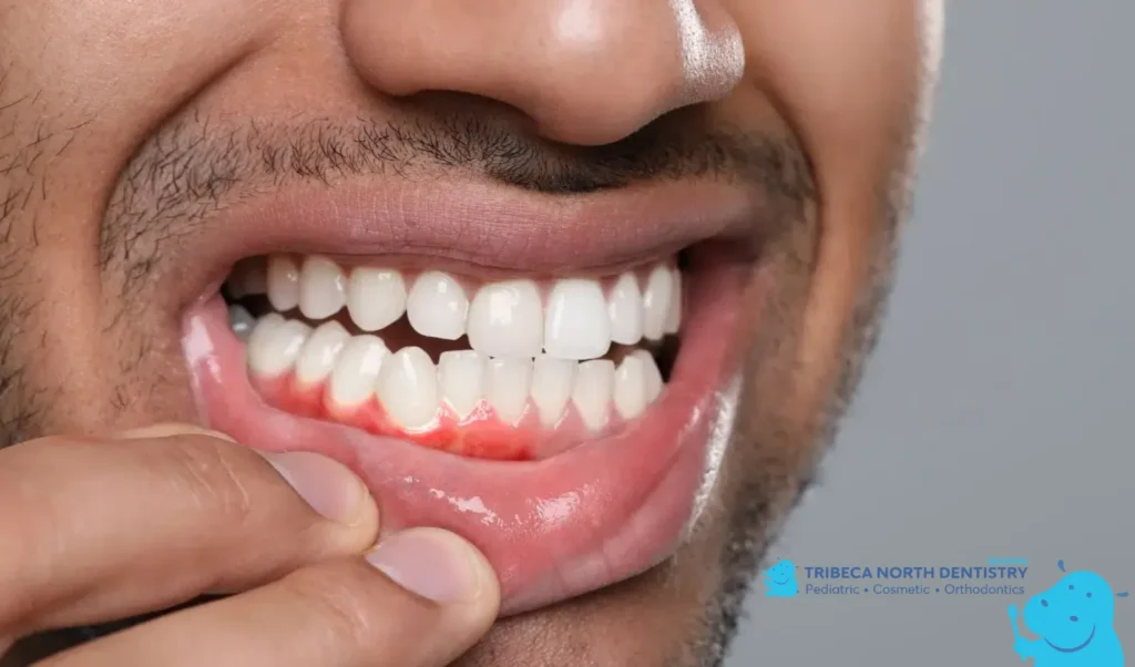 Why Tooth Pain Can Happen After Dental Work
