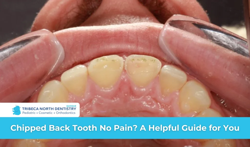 Chipped Back Tooth No Pain A Helpful Guide for You