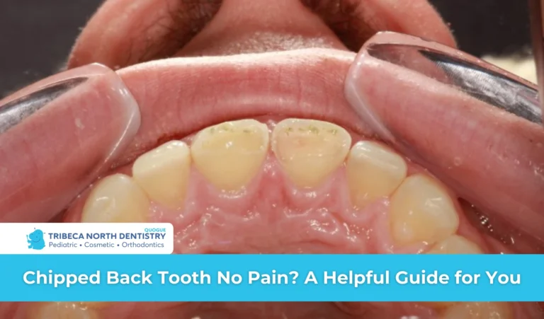 Chipped Back Tooth No Pain A Helpful Guide for You