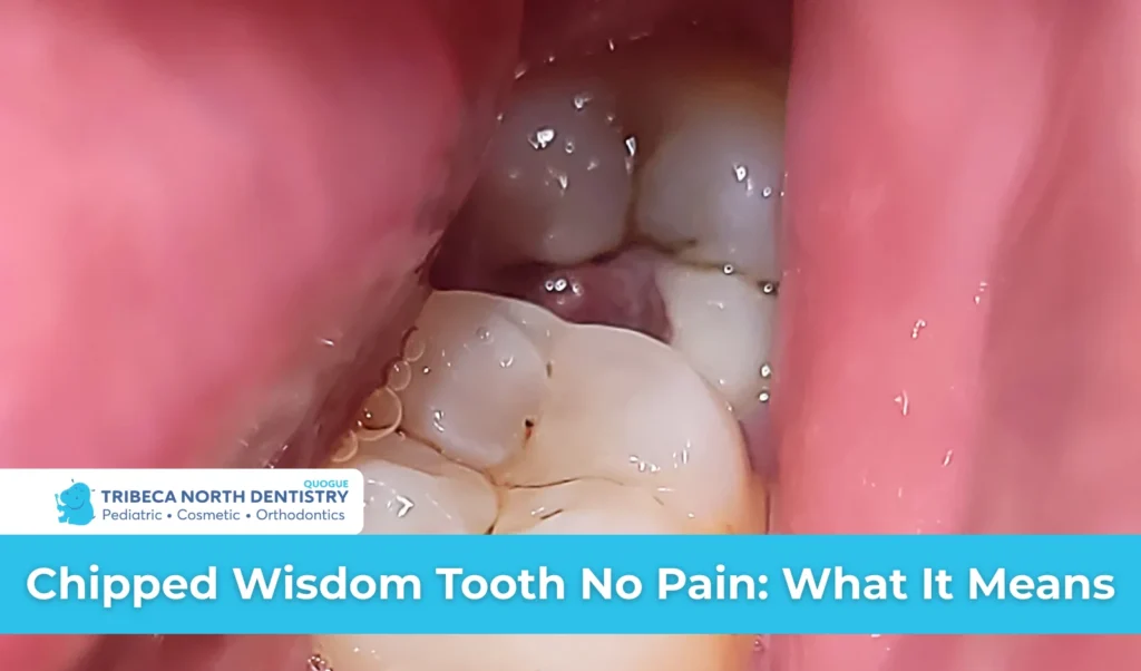 Chipped Wisdom Tooth No Pain What It Means