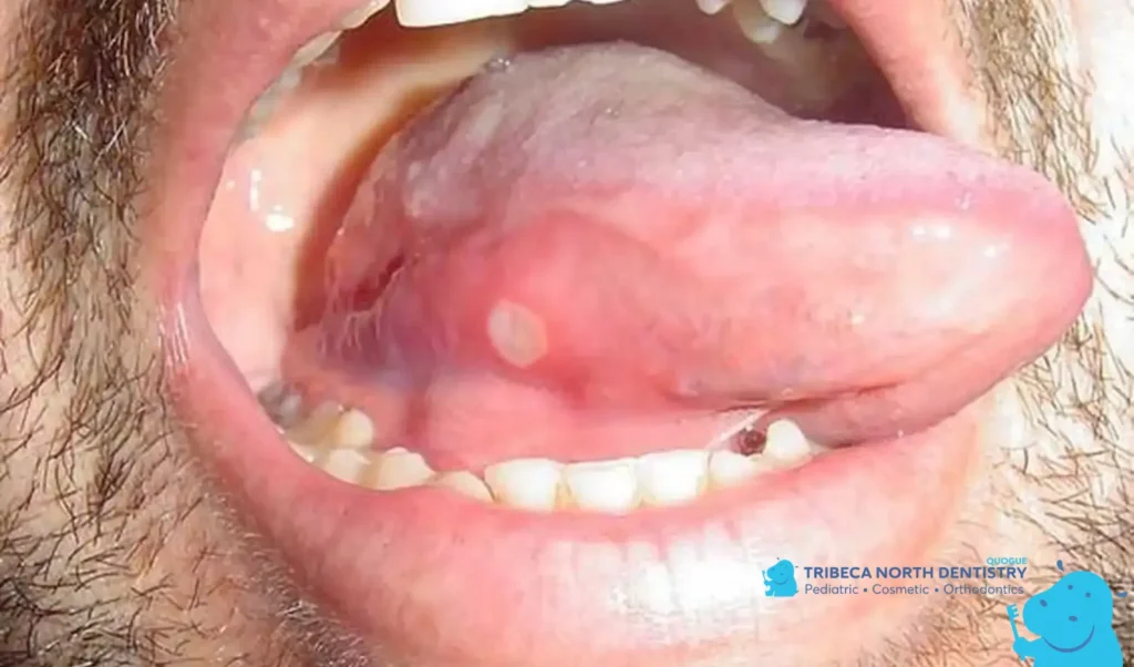 Common Signs to Notice