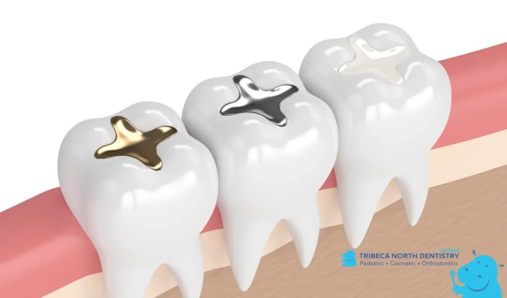 Dental Solutions for Chipped Teeth