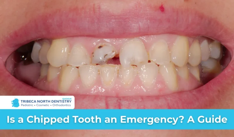 Is a Chipped Tooth an Emergency A Guide