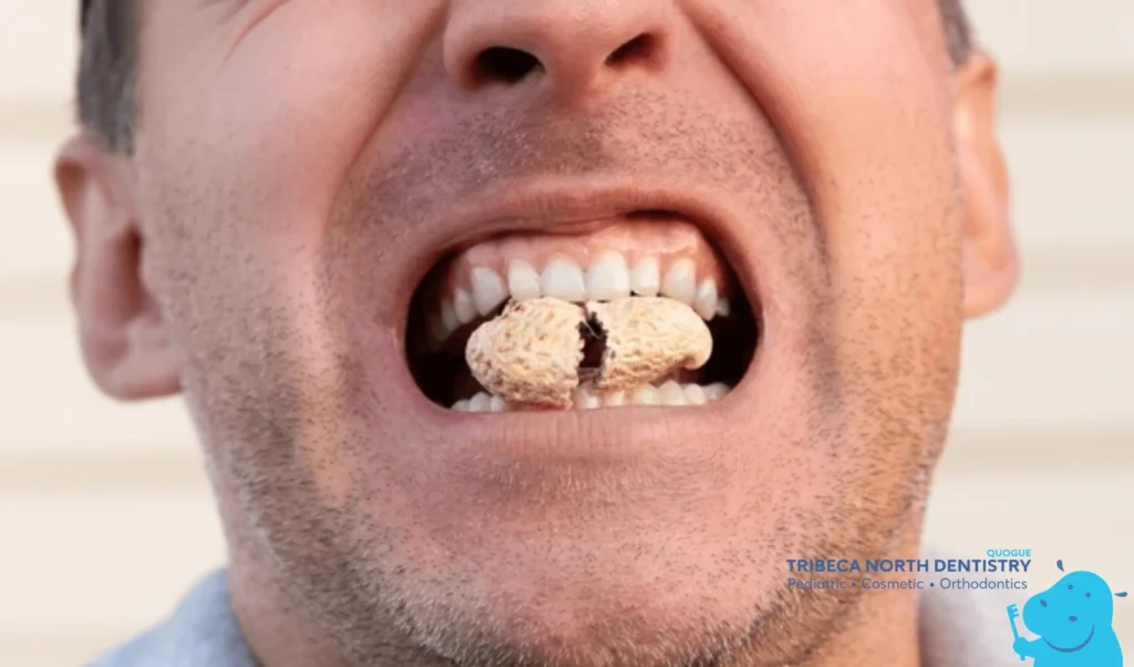 What Can Cause a Chipped Tooth?