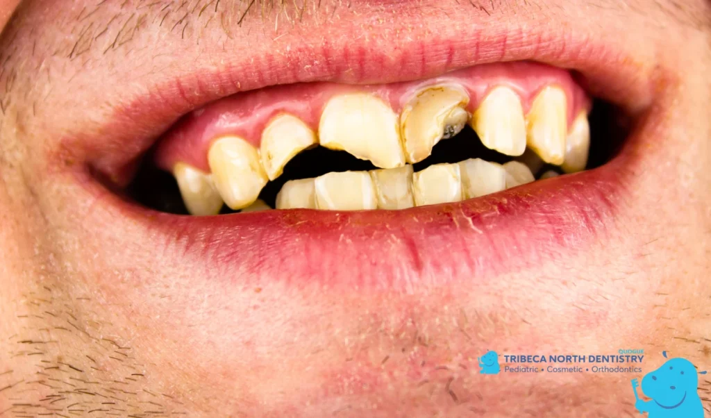 Why Early Awareness Matters